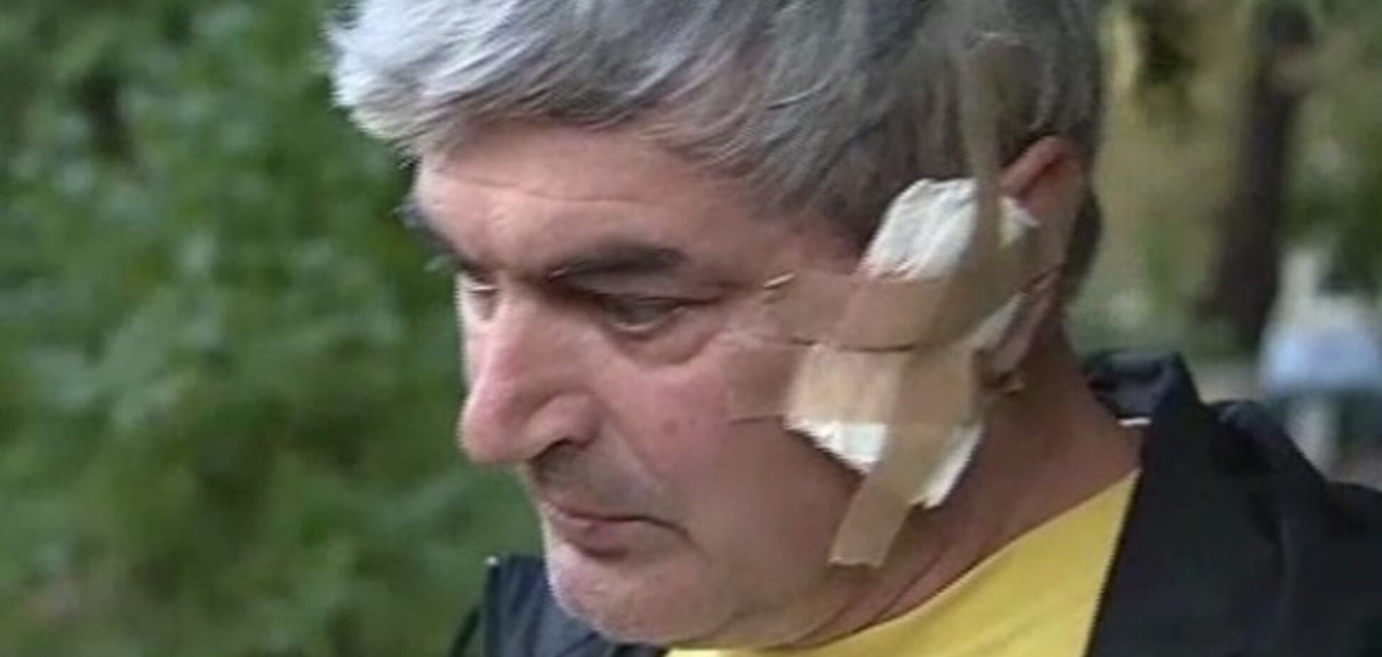 На Киевщине недовольный рыбак пытался убить журналиста