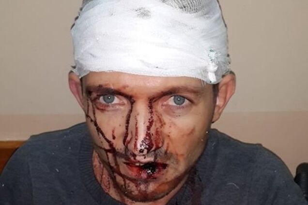 Жестоко избит заместитель главы Антикоррупционного бюро в Херсонской области