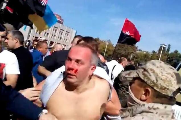 Порошенко требует разобраться с избиением Шуфрича