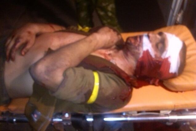 Террористы в Счастье взяли в плен бойцов 'Айдара'