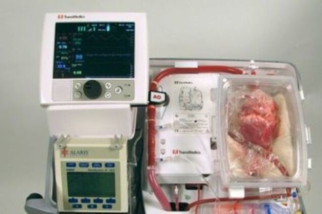 Впервые в мире пациенту пересадили сердце от мертвого донора 