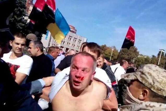 Милиция установила 14 человек, избивших Шуфрича