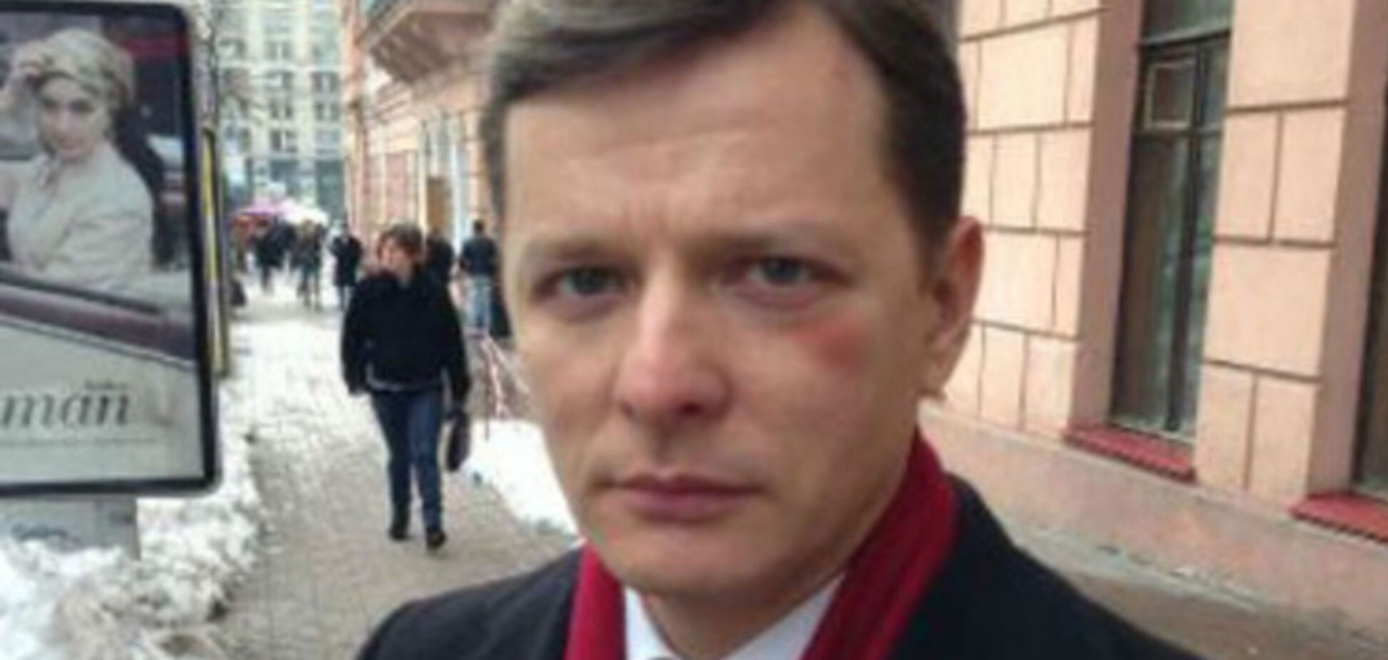 Ляшко нуждается в избиении