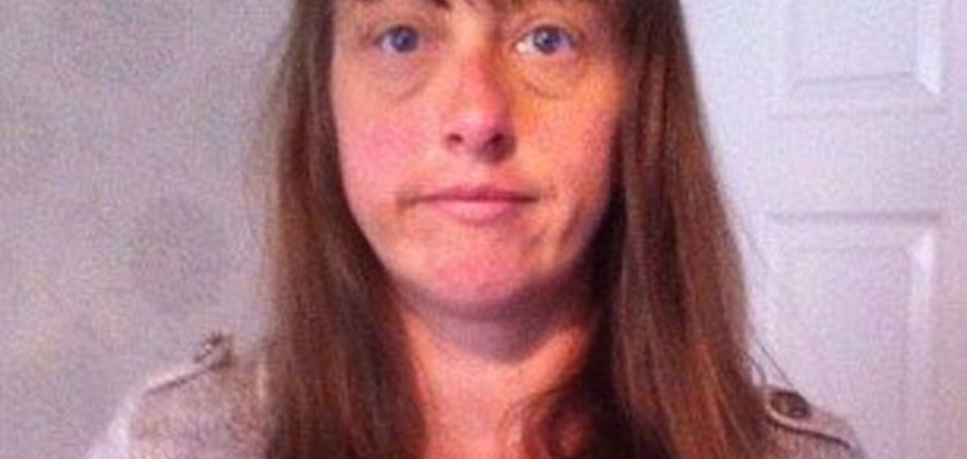 Страшная аллергия на краску для волос изуродовала женщину до неузнаваемости