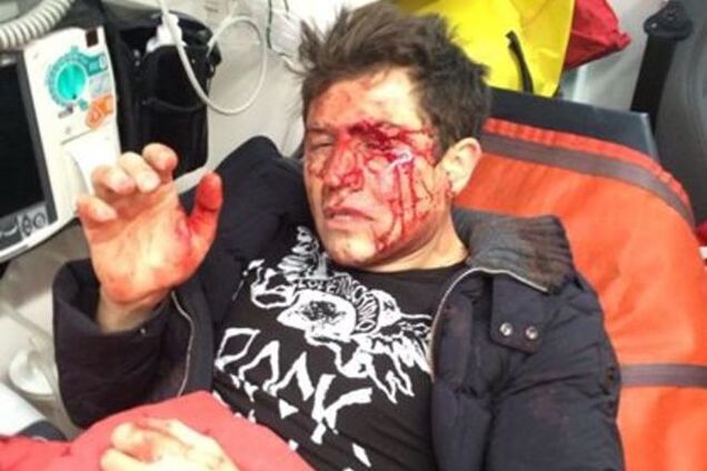 Андрея Джеджулу пытались убить: врачи зашивают лицо артиста и собирают его кости