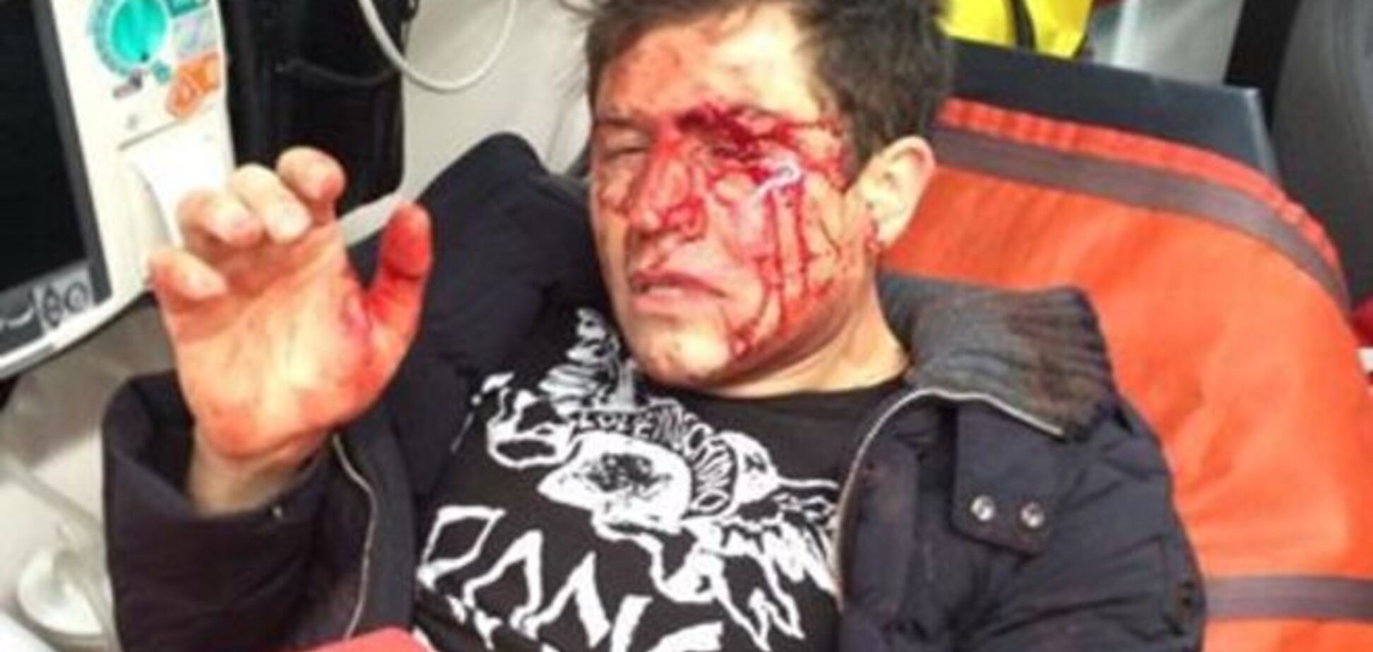 Андрея Джеджулу пытались убить: врачи зашивают лицо артиста и собирают его кости