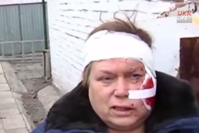 Раненые жители Донецка признали, что их обстреляли боевики 'ДНР'