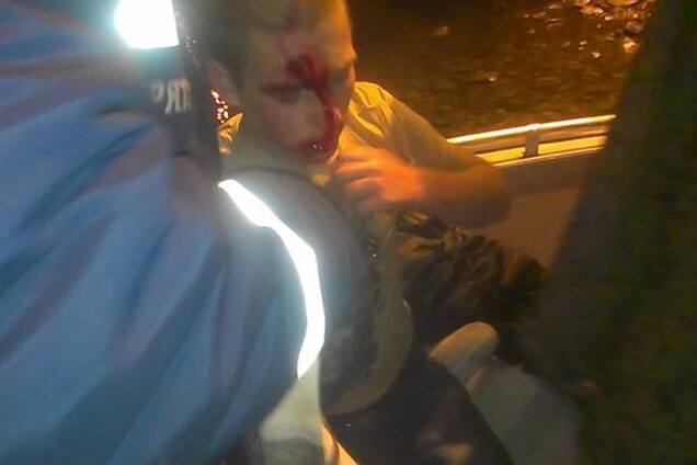 В Киеве расстроенный школьник прыгнул с моста: появились фото спасения