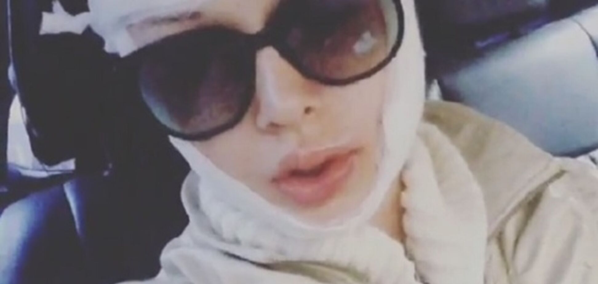 Одесская Барби заявила о нападении на нее в ночь Хеллоуина: фото с перебинтованным лицом и изрезанными губами
