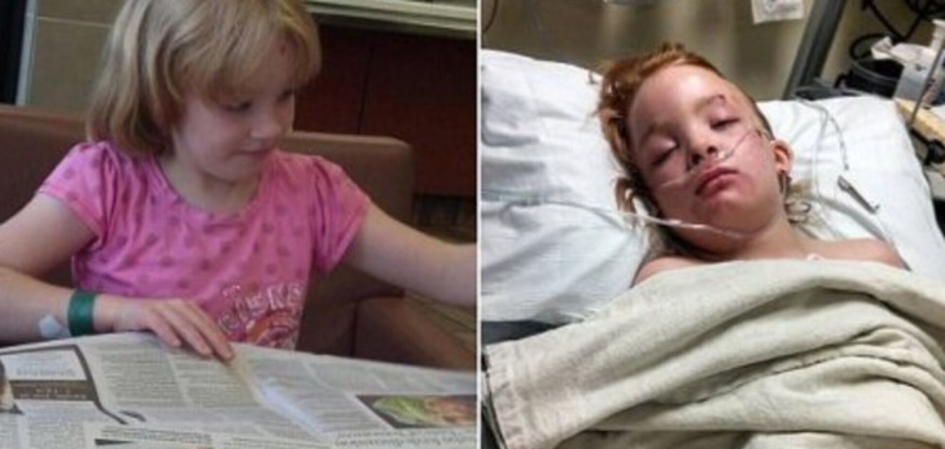 10-летнюю девочку парализовало после прививки от гриппа