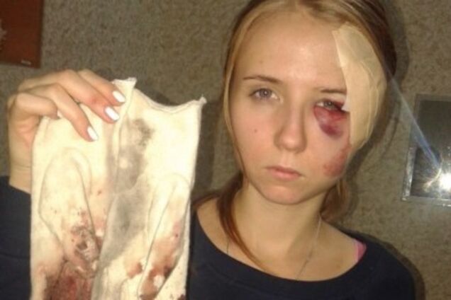 В Одессе бизнесмен на внедорожнике сбил на 'зебре' девушку