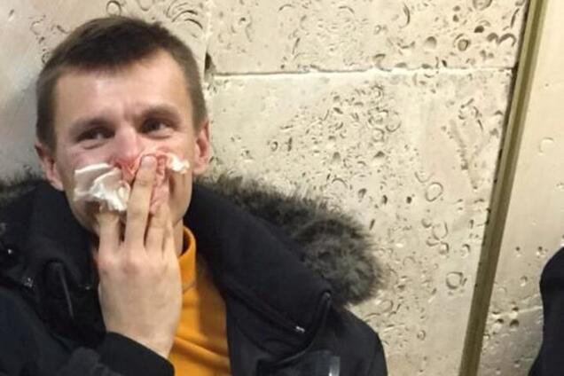 Лидера Автомайдана Кобу задержали, избили и доставили в суд: опубликованы фото