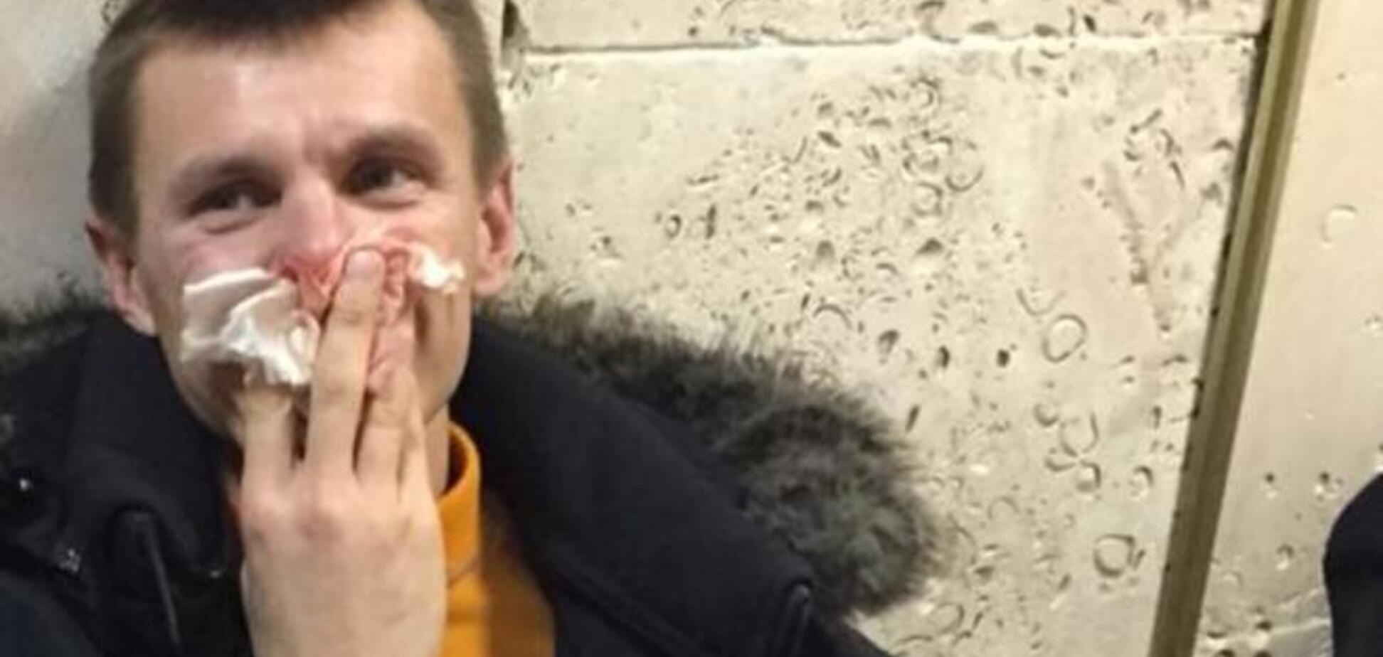 Лидера Автомайдана Кобу задержали, избили и доставили в суд: опубликованы фото