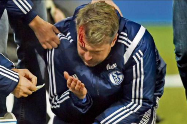 В Германии разбили голову тренеру 'российского' клуба