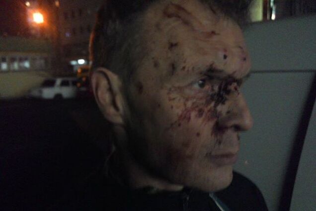 В Киеве мажор жестоко избил отца добровольца из 'Азова': опубликовано фото