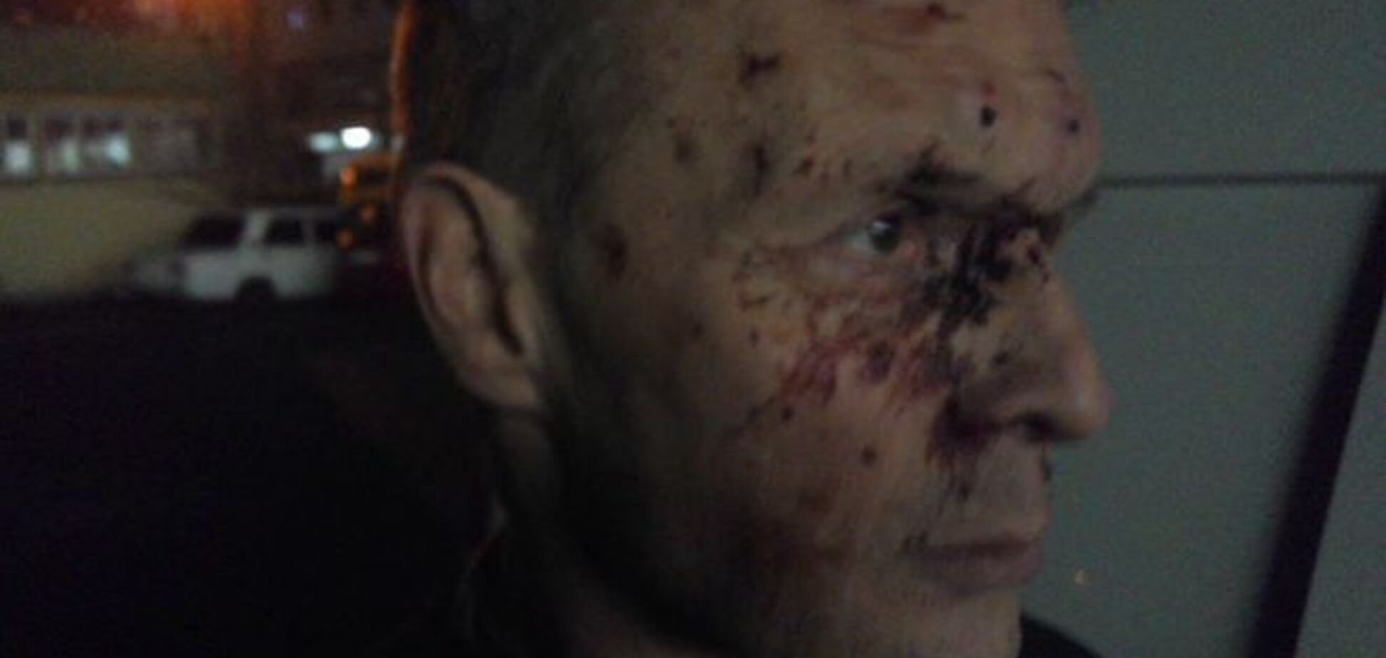 В Киеве мажор жестоко избил отца добровольца из 'Азова': опубликовано фото