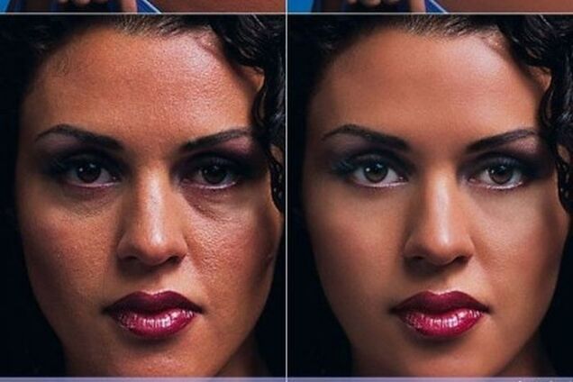 Чудеса фотошопа: 20 шокирующих фотографий знаменитостей