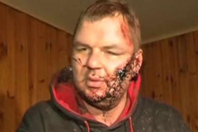 Міліція не збирається брати під варту Булатова - Захарченко