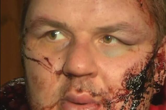 Булатов до сих пор находится без сознания