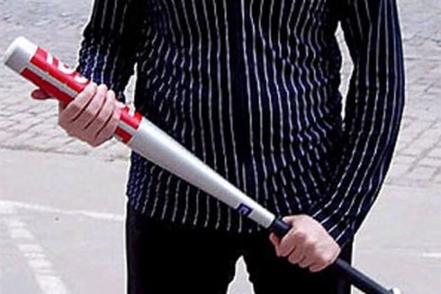 В Чернигове неизвестные избили журналиста до сотрясения мозга