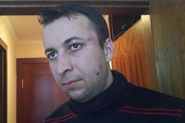 Беркутовцы избили журналиста и оператора '5 канала'