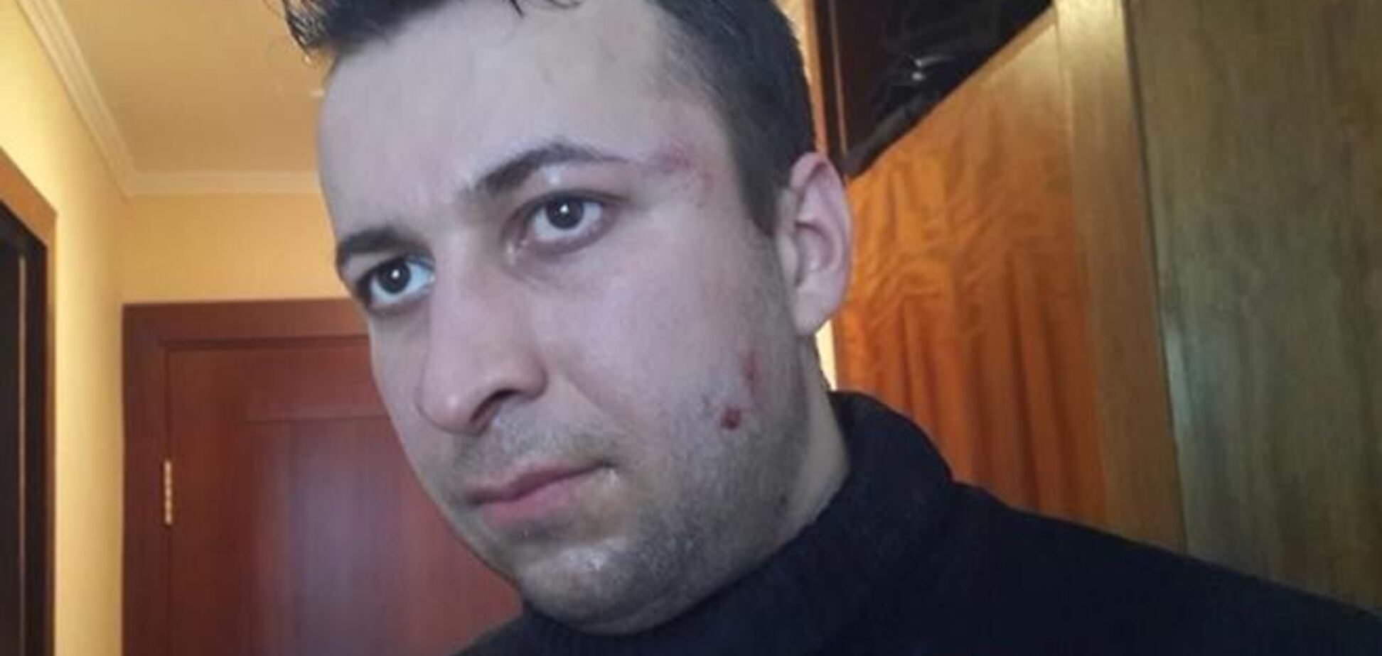 Беркутовцы избили журналиста и оператора '5 канала'