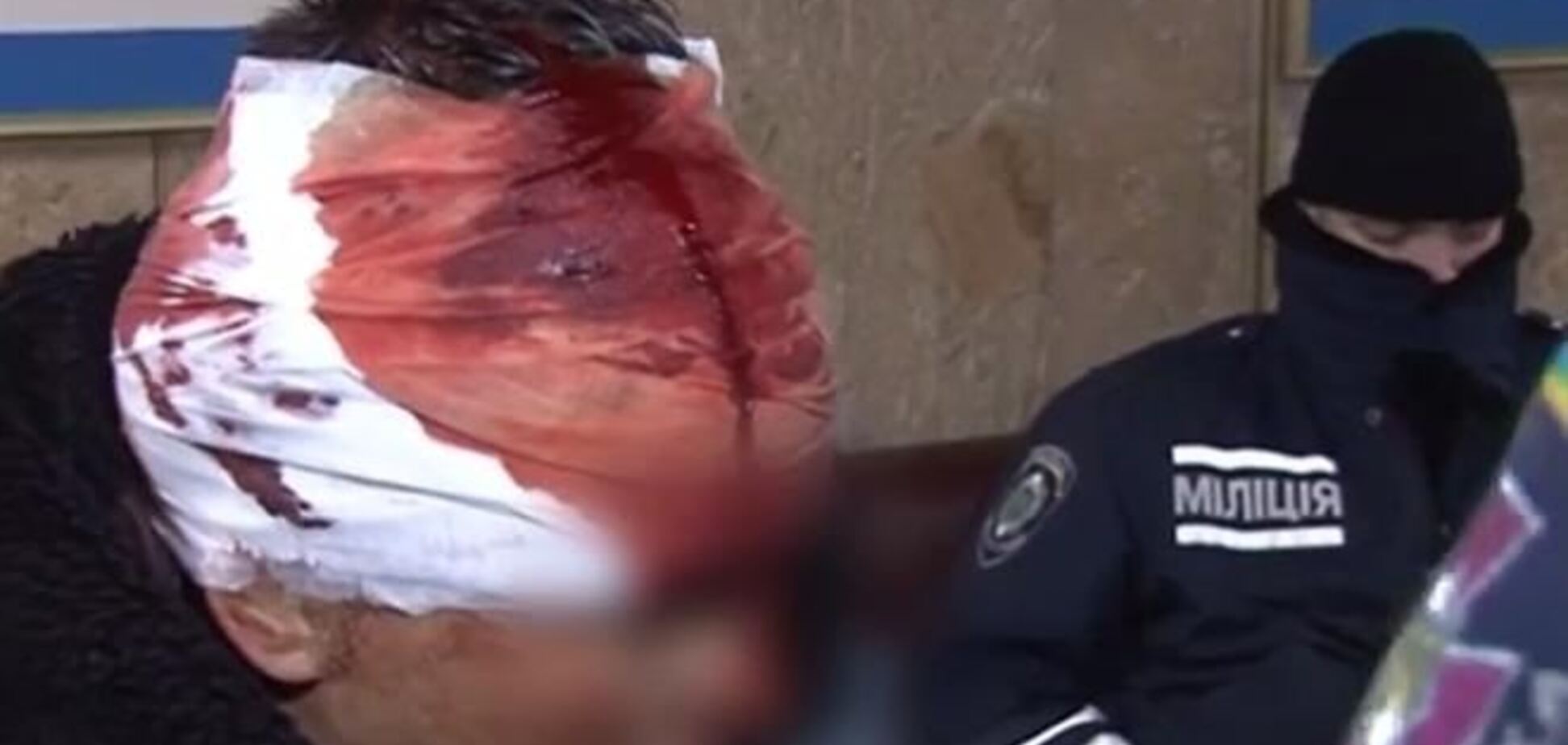 В ходе столкновений трое силовиков погибло, 159 ранены - МВД