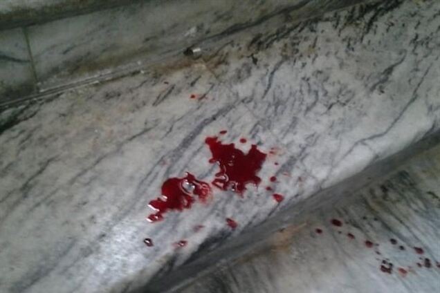 Мітингувальники в Луцьку побили губернатора