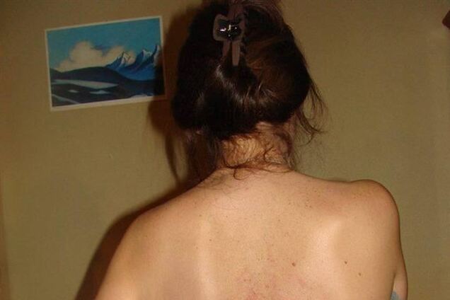 Киянка, в яку потрапила граната: я знала, на що йду