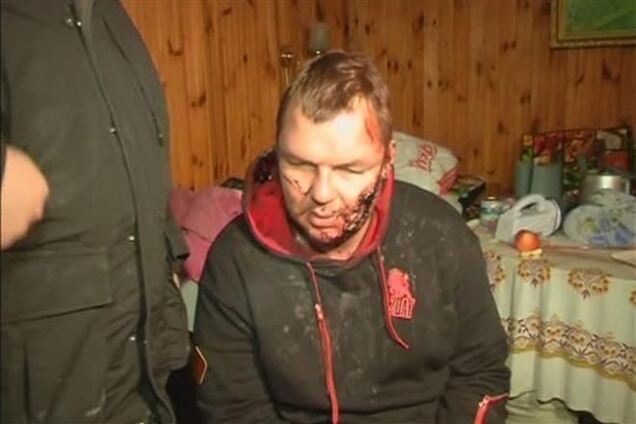 Милиция опять пытается арестовать Булатова в больнице – 'Свобода'