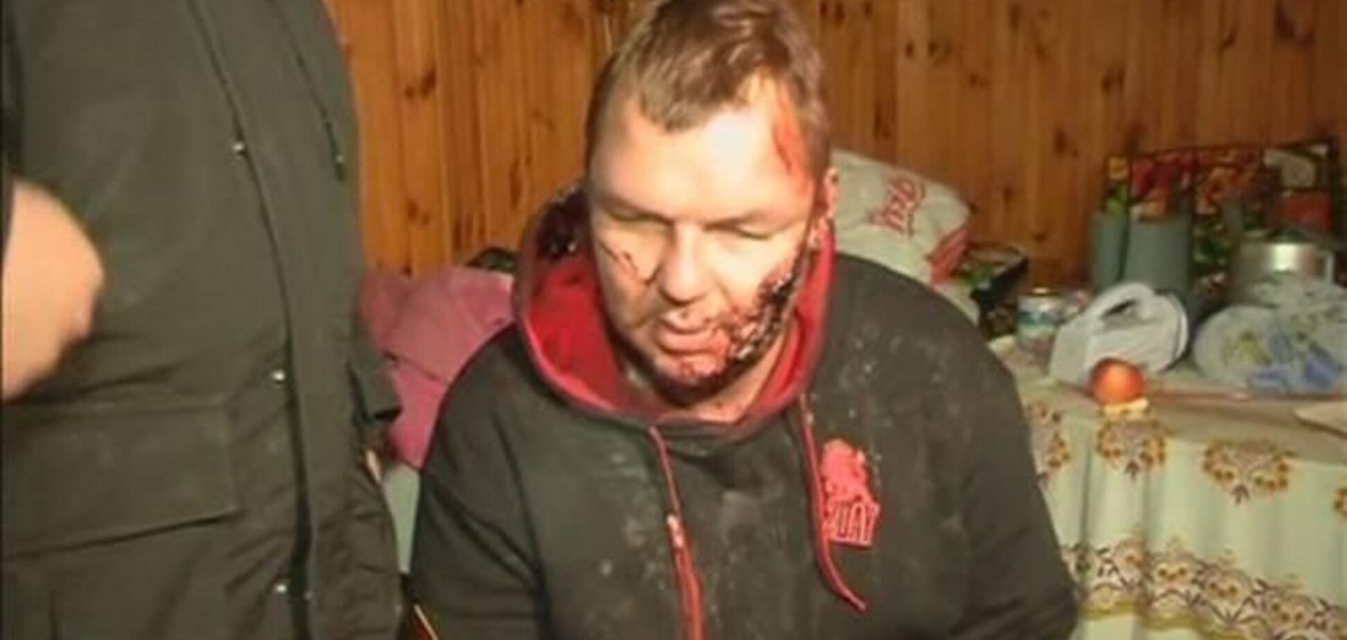 Булатова відправлять на лікування або у Німеччину, або в Литву - Бригинець