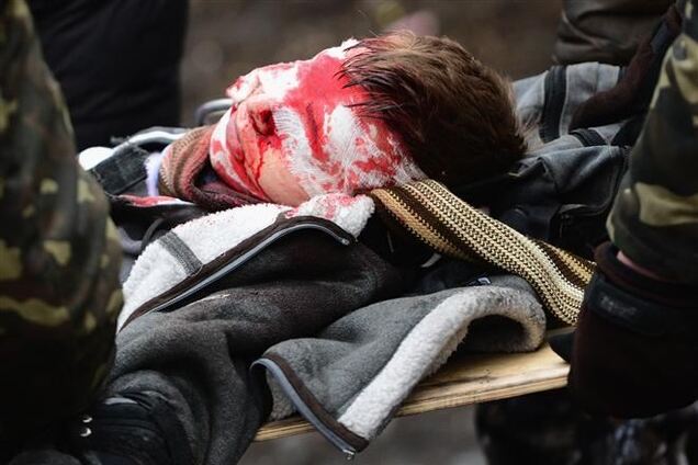 Самые страшные фото Майдана