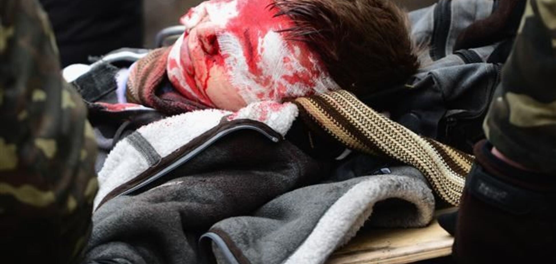 Самые страшные фото Майдана