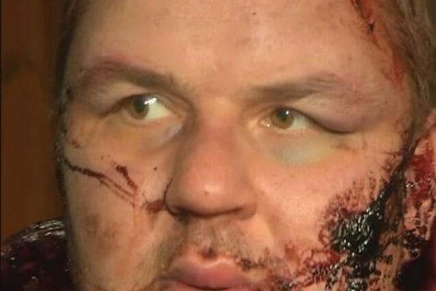 Милиция допросила Булатова до того, как его доставили на лечение в Европу