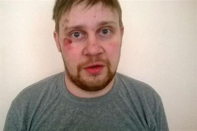 Російський журналіст розповів, як його били в Києві