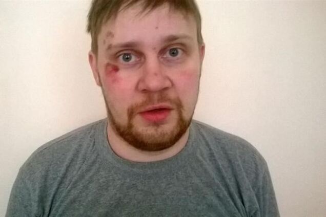 Російський журналіст, побитий в центрі Києва, був сильно п'яний - міліція