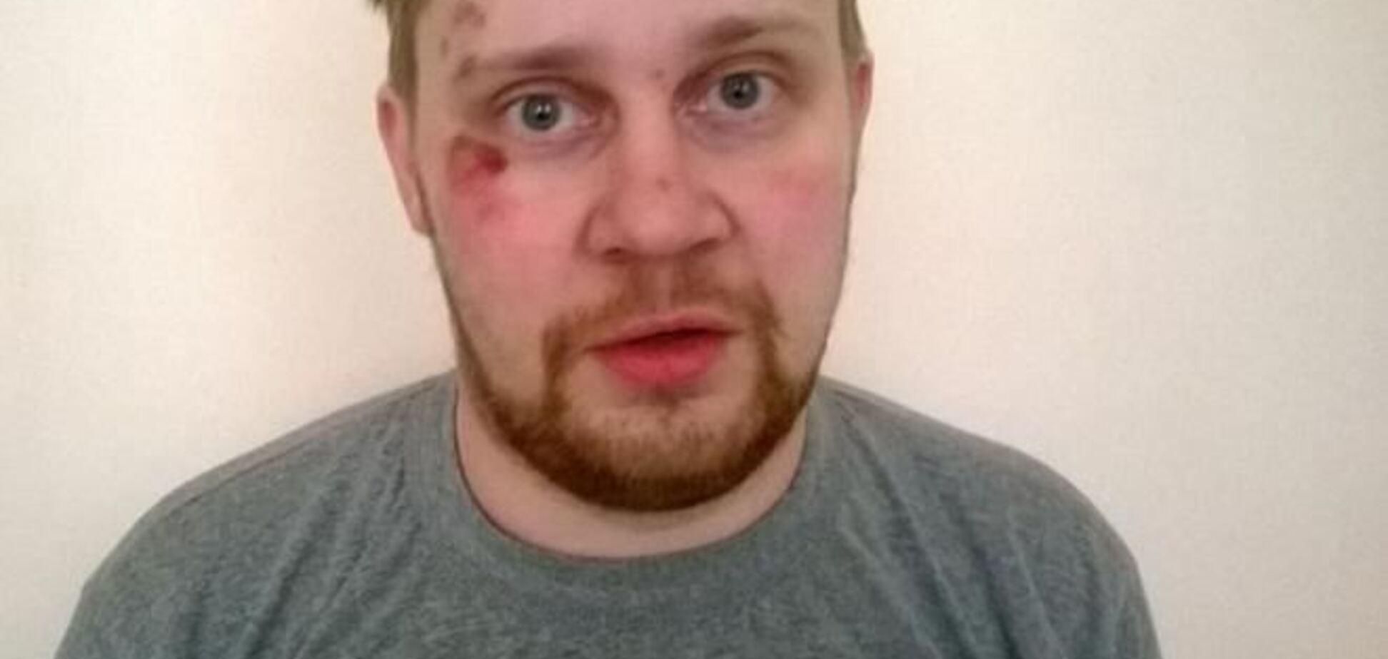 Російський журналіст, побитий в центрі Києва, був сильно п'яний - міліція