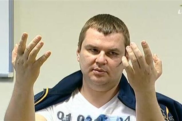 Лечащий доктор Булатова подтвердил, что его пациента пытали