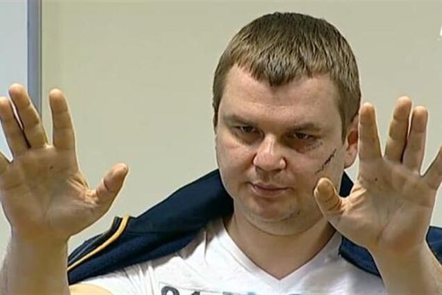 МЗС Литви призначив судово-медичну експертизу травм Булатова