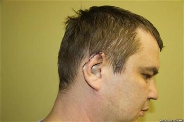 Литва провела судово-медичну експертизу травм Булатова