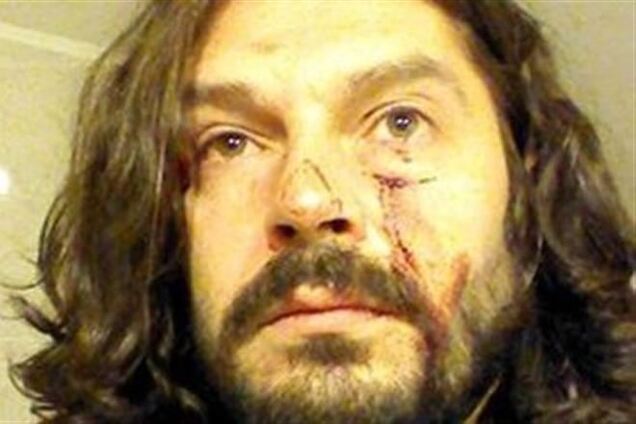 В Крыму журналистам разбили лица и выбили зубы