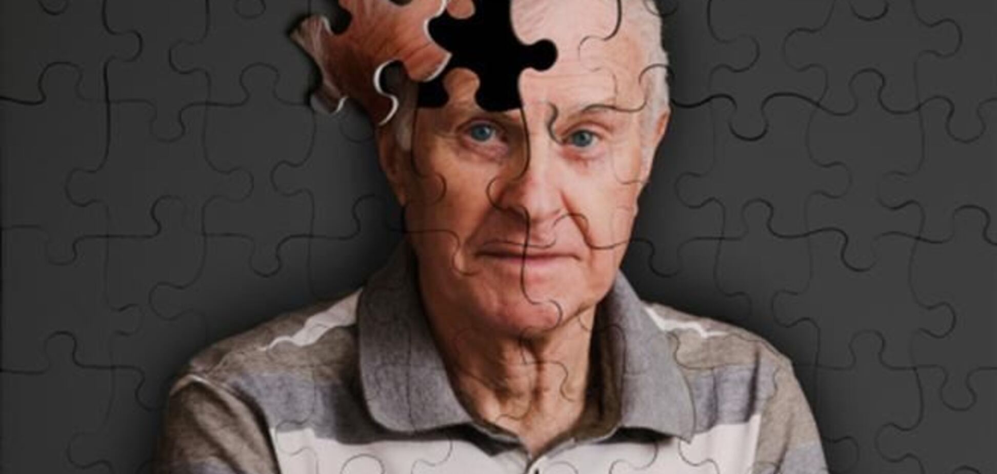 Как определить болезнь Альцгеймера без врача