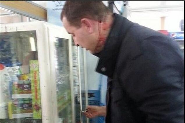 В Одессе пророссийские активисты с цепями напали на сторонников единой Украины. Царева вывел спецназ