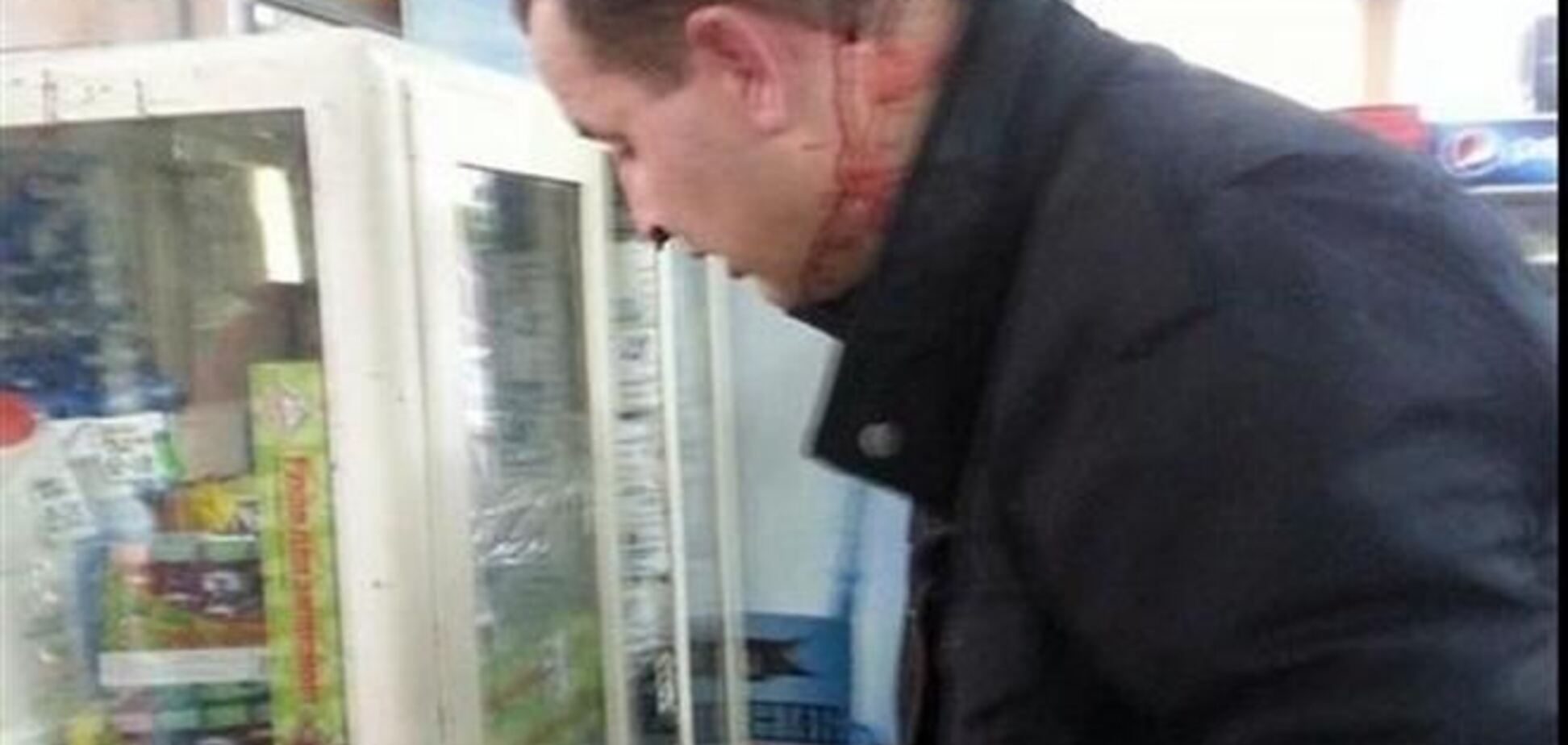 В Одесі проросійські активісти з ланцюгами напали на прихильників єдиної України. Царьова вивів спецназ