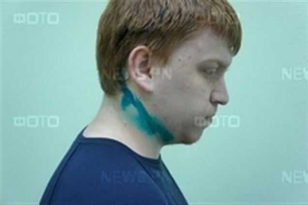 В Николаеве сторонники Путина облили журналиста зеленкой и назвали фашистом