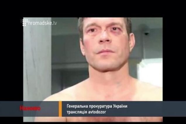 Царева избили в Киеве. Он в 'тяжелом состоянии'