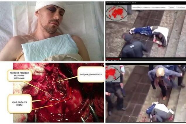 Активист из Харькова, которого била ногами женщина, в реанимации