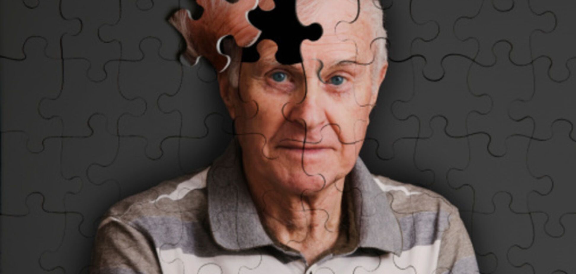 Найден простой способ остановить болезнь Альцгеймера