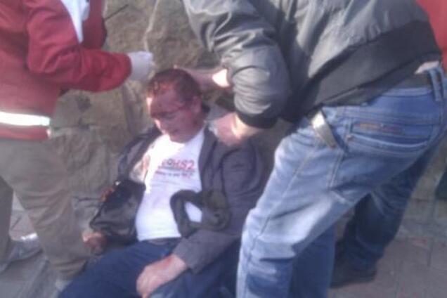 Драка сепаратистов и ультрас в Харькове: милиция открыла производство