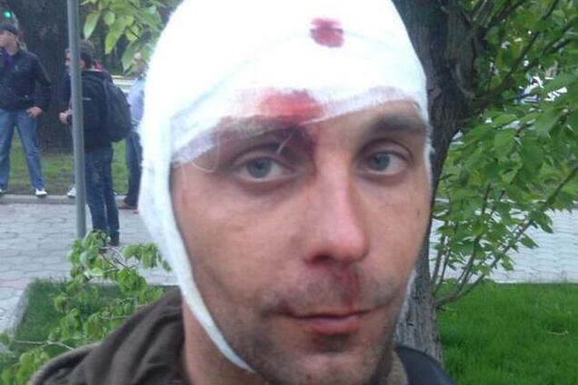 Во время столкновений в Донецке разбили голову журналисту